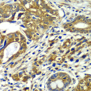 CDC16 Rabbit Polyclonal Antibody - Image 3