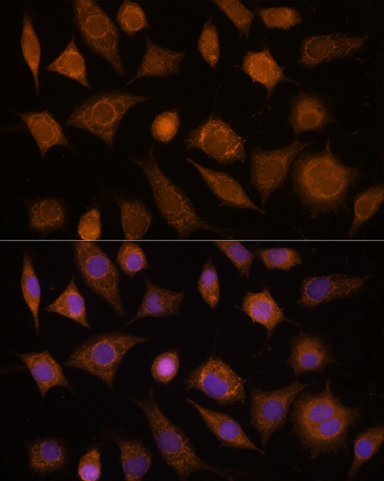 CDC20 Rabbit Polyclonal Antibody - Image 2