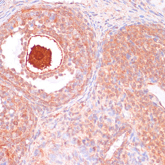 CDC20 Rabbit Polyclonal Antibody - Image 2