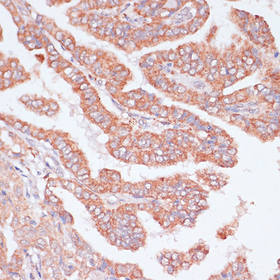 CDC20 Rabbit Polyclonal Antibody - Image 4