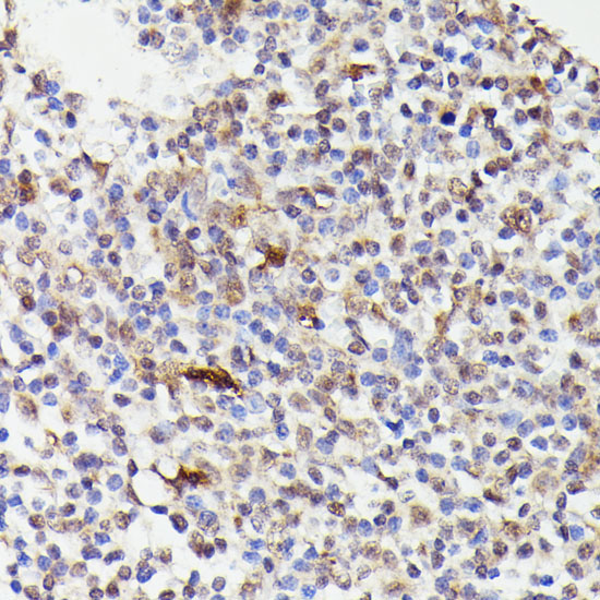 CDC23 Rabbit Polyclonal Antibody - Image 3