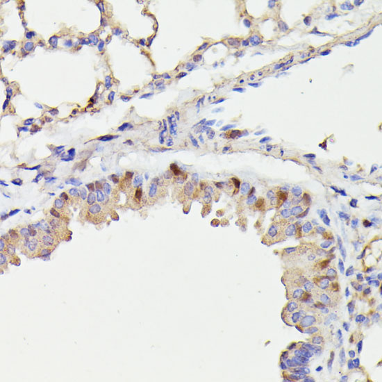 CDC23 Rabbit Polyclonal Antibody - Image 4