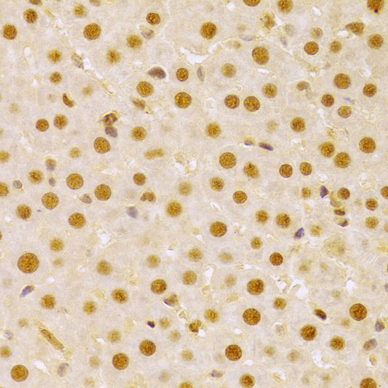 CDC25A Rabbit Polyclonal Antibody - Image 2