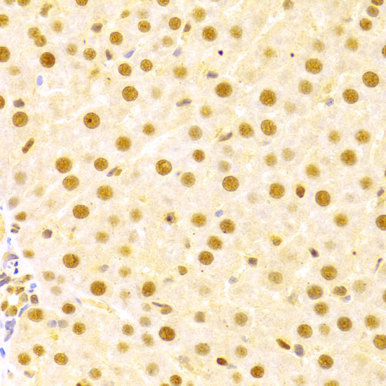 CDC25A Rabbit Polyclonal Antibody - Image 3