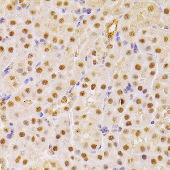 CDC25A Rabbit Polyclonal Antibody - Image 4