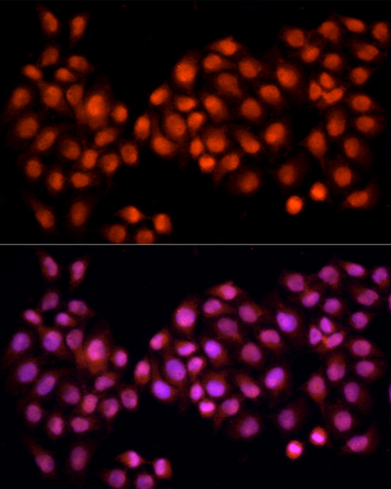 CDC25A Rabbit Polyclonal Antibody - Image 5