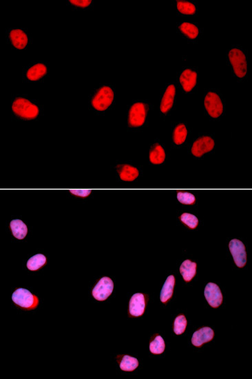CDC25C Rabbit Polyclonal Antibody