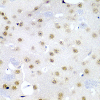 CDC27 Rabbit Polyclonal Antibody - Image 3