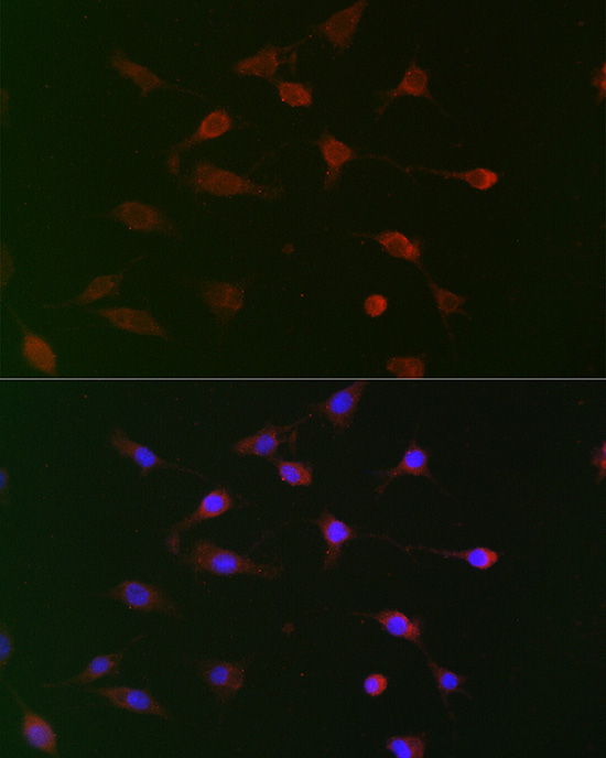 CDC34 Rabbit Polyclonal Antibody - Image 3