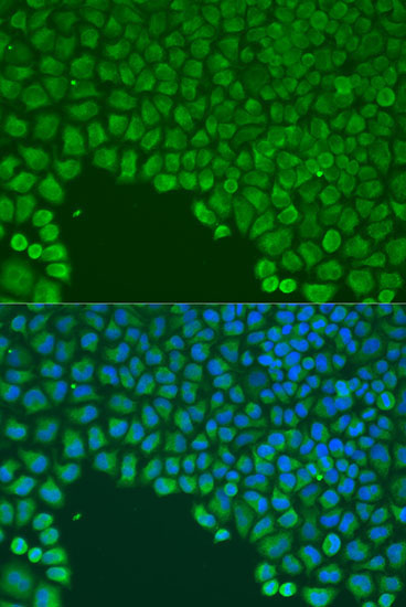 CDC42 Rabbit Polyclonal Antibody