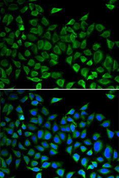 CDC45 Rabbit Polyclonal Antibody