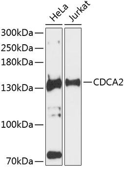 CDCA2 Rabbit Polyclonal Antibody