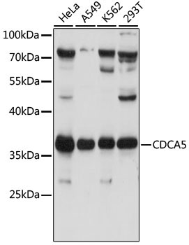 CDCA5 Rabbit Polyclonal Antibody