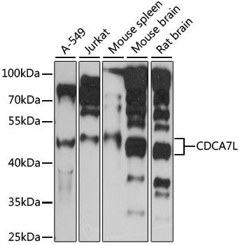 CDCA7L Rabbit Polyclonal Antibody