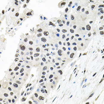 CDCA8 Rabbit Polyclonal Antibody - Image 2