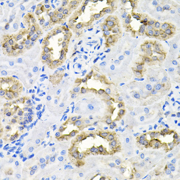 CDCA8 Rabbit Polyclonal Antibody - Image 3