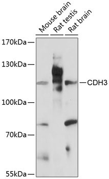 CDH3 Rabbit Polyclonal Antibody