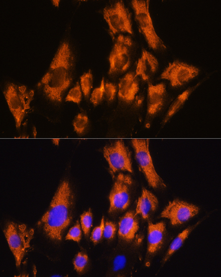 CDH8 Rabbit Polyclonal Antibody - Image 2