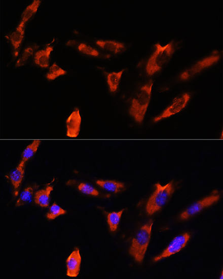 CDH8 Rabbit Polyclonal Antibody - Image 3