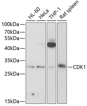 CDK1 Rabbit Polyclonal Antibody