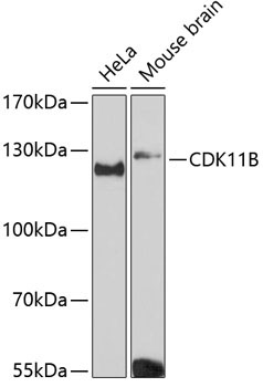 CDK11B Rabbit Polyclonal Antibody