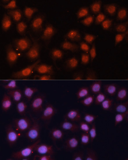 CDK11B Rabbit Polyclonal Antibody - Image 2