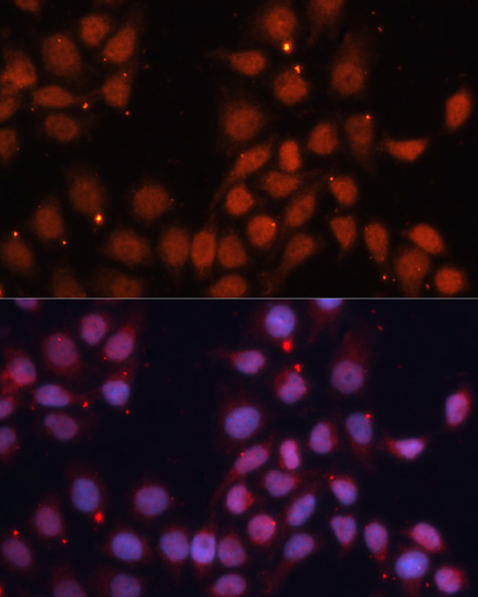 CDK11B Rabbit Polyclonal Antibody