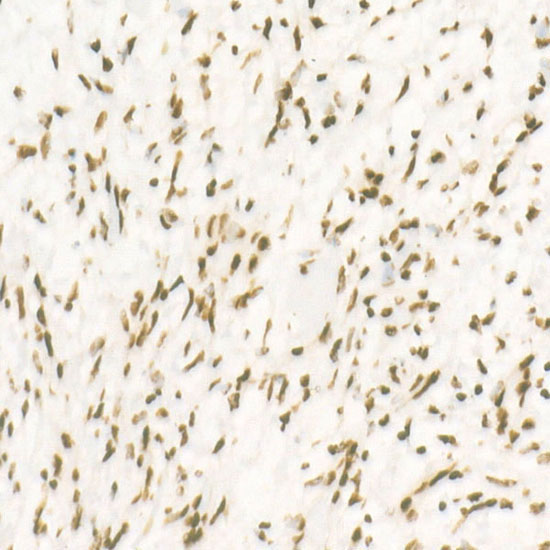 CDK12 Rabbit Monoclonal Antibody