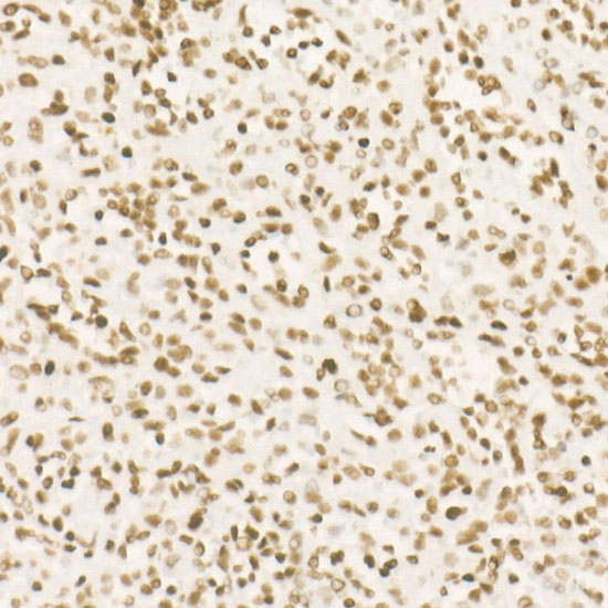 CDK12 Rabbit Monoclonal Antibody - Image 2