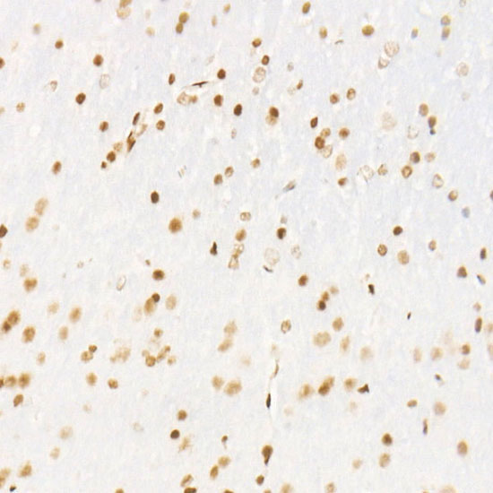 CDK12 Rabbit Monoclonal Antibody - Image 3