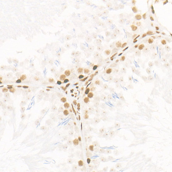 CDK12 Rabbit Monoclonal Antibody - Image 4
