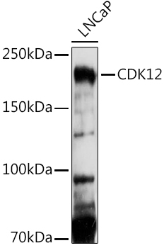 CDK12 Rabbit Polyclonal Antibody