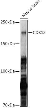 CDK12 Rabbit Polyclonal Antibody - Image 2