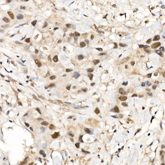 CDK12 Rabbit Polyclonal Antibody - Image 3