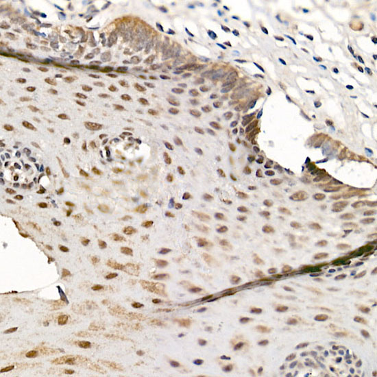 CDK12 Rabbit Polyclonal Antibody - Image 4