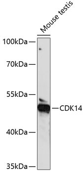 CDK14 Rabbit Polyclonal Antibody
