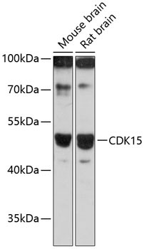 CDK15 Rabbit Polyclonal Antibody