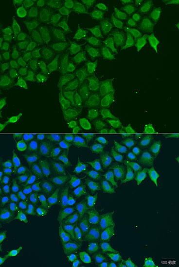 CDK16 Rabbit Polyclonal Antibody