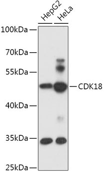 CDK18 Rabbit Polyclonal Antibody