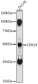 CDK19 Rabbit Polyclonal Antibody