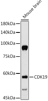 CDK19 Rabbit Polyclonal Antibody - Image 2