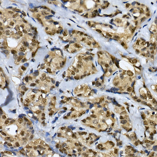 CDK19 Rabbit Polyclonal Antibody - Image 3