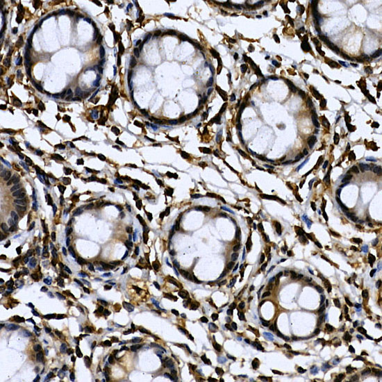 CDK19 Rabbit Polyclonal Antibody - Image 4