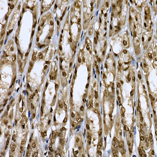CDK19 Rabbit Polyclonal Antibody - Image 5
