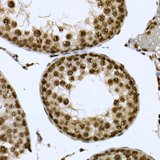 CDK19 Rabbit Polyclonal Antibody - Image 6