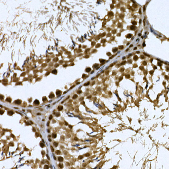 CDK19 Rabbit Polyclonal Antibody - Image 7