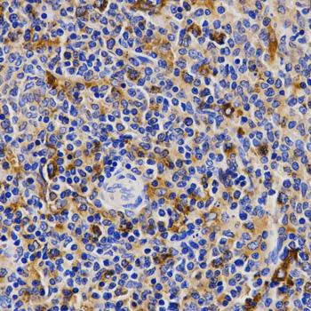 CDK20 Rabbit Polyclonal Antibody