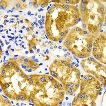 CDK20 Rabbit Polyclonal Antibody - Image 2