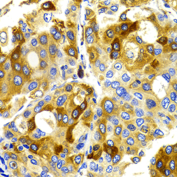 CDK20 Rabbit Polyclonal Antibody - Image 3