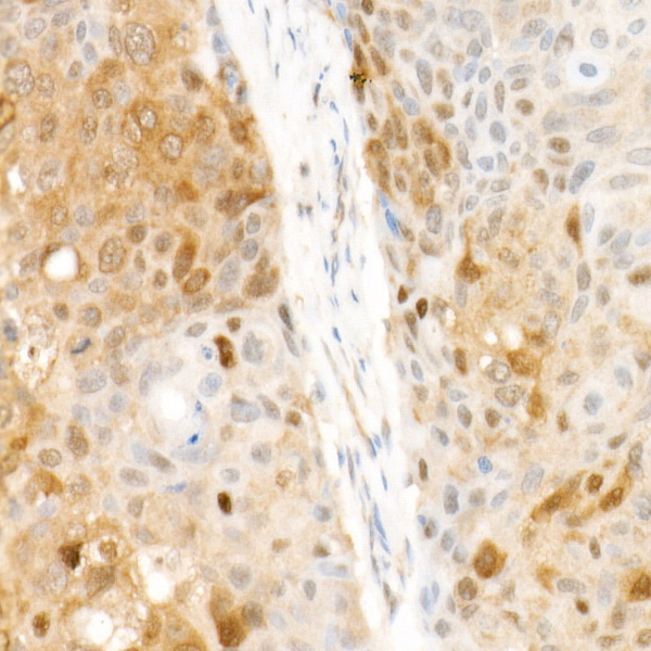 CDK4 Rabbit Monoclonal Antibody - Image 2